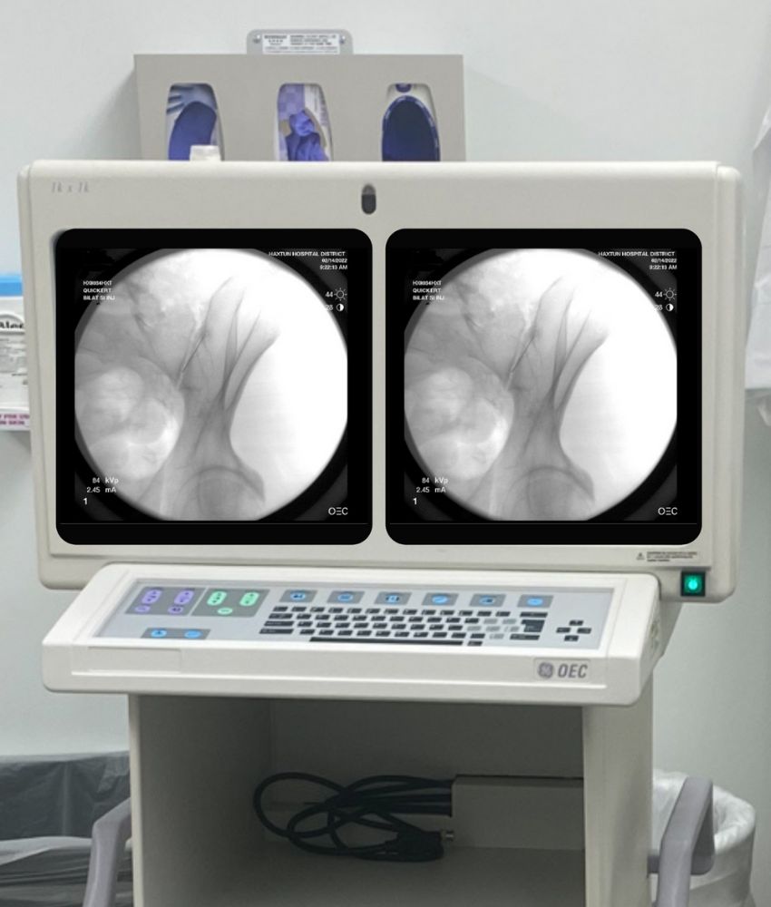 C-ARM imaging